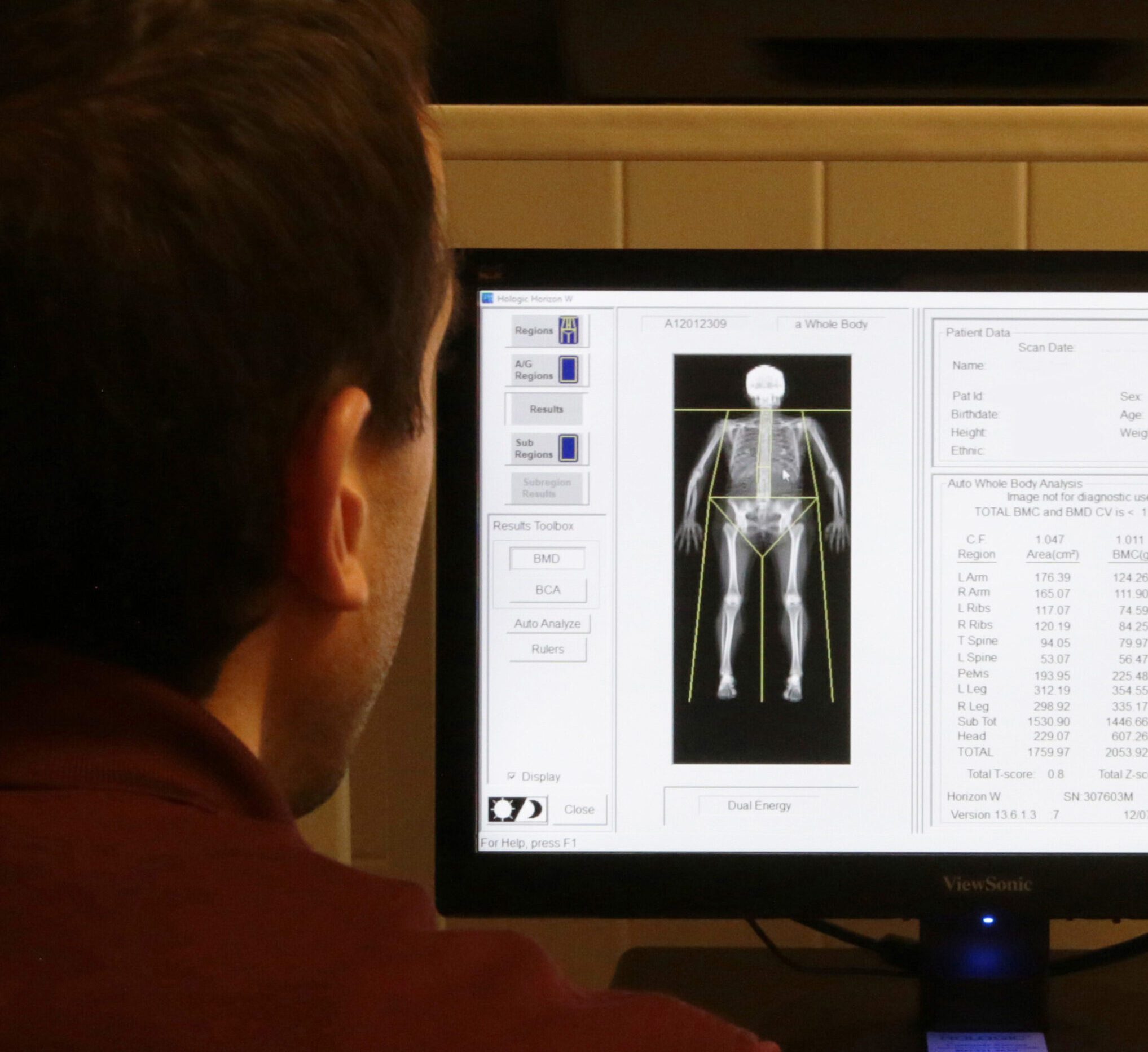 An Alma College faculty member looking at a screen and analyzing data gathered from a DEXA scanner on campus.